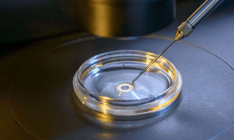 What is Intracytoplasmic sperm injection (ICSI) fertility treatment