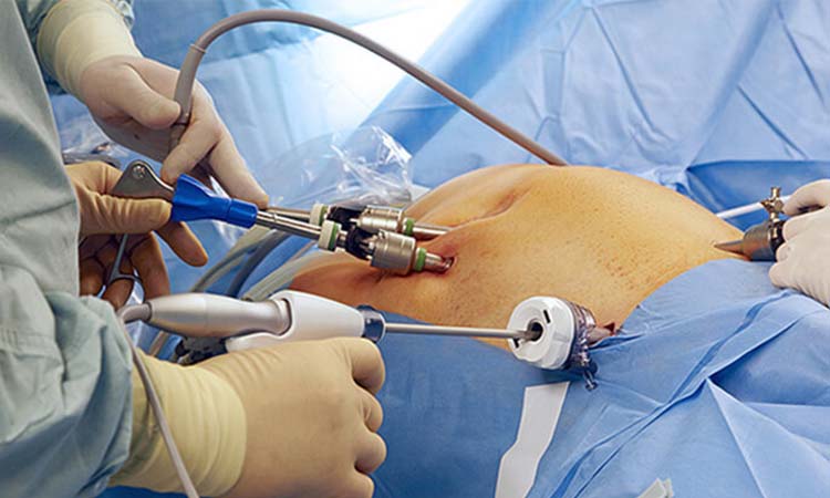 Hysteroscopy Treatment